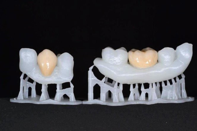 3D Printing in Healthcare Emerging Applications | Novel Organ Printing